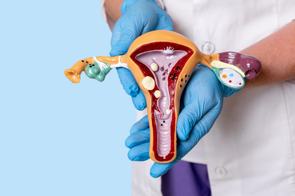 Modèle anatomique de l’utérus et des ovaires présenté par un professionnel de santé pour expliquer les pathologies gynécologiques.